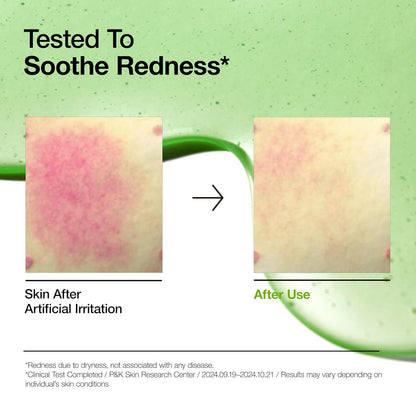 Anua Azelaic Acid 10% Hyaluron Redness Soothing Serum