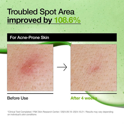 Anua Azelaic Acid 10% Hyaluron Redness Soothing Serum